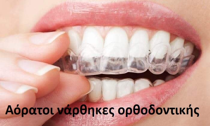 Ορθοδοντική με αόρατους νάρθηκες στο Αιγαλεω